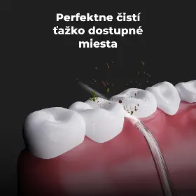Ústna sprcha - AENO DI1 - 11