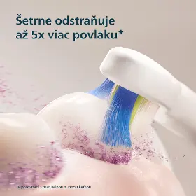 Sonická zubná kefka - Philips HX4033/21 Sonicare 3100 - 5