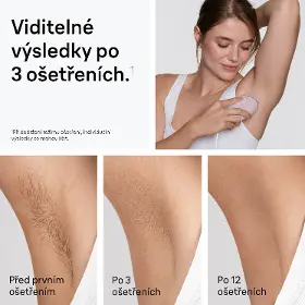 IPL epilátor - Braun PL1111 Silk·expert Mini - 4