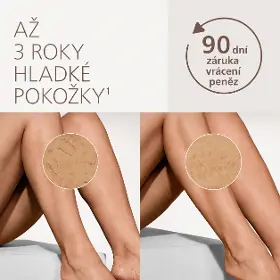 IPL epilátor - Philips BRI930/00 Lumea IPL 7000 Series + Cashback až 4000 Kč - 10