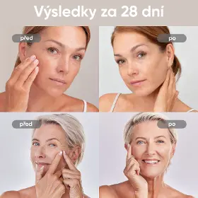 LED maska - Jovs JM2P 4D v2 laserová světelná terapeutická maska - 9
