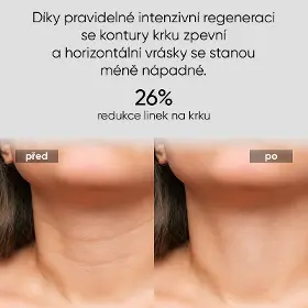 LED maska - Jovs JNL1 LED světelná maska na krk a hrudník - 3