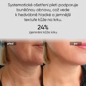 LED maska - Jovs JNL1 LED světelná maska na krk a hrudník - 4