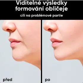 Přístroj na čistení pleti - Jovs JE2 Slimax mikroproudový omlazující přístroj - 7