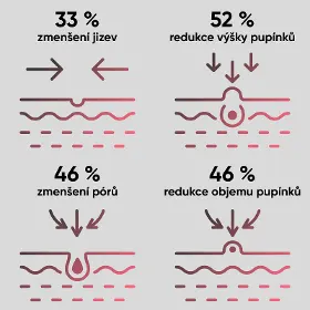 Přístroj na čistení pleti - Jovs JA3 Acneaway přístroj na léčbu akné - 3