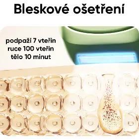 IPL epilátor - Jovs JR10 Scroll IPL/OPT přístroj na odstraňování chloupků - 5