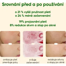 Přístroj na čistení pleti - Jovs JP1P Blacken Pro DPL fotofacial přístroj na péči o pleť - 7